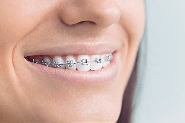 Best Full Mouth Reconstruction  in Bloomfield, IN